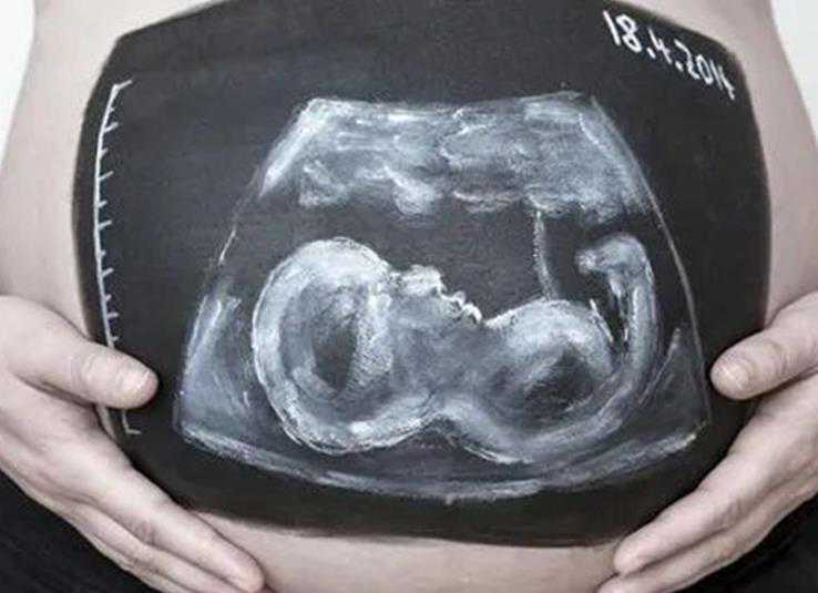 宁波哪家医院做试管婴儿的技术比较好 宁波市一医院推荐理由 ‘男孕囊和女孕